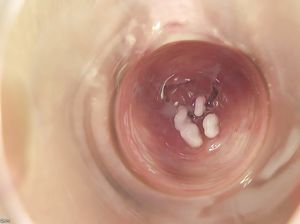 Телка вставила в вагину колбу и показала ее крупным планом